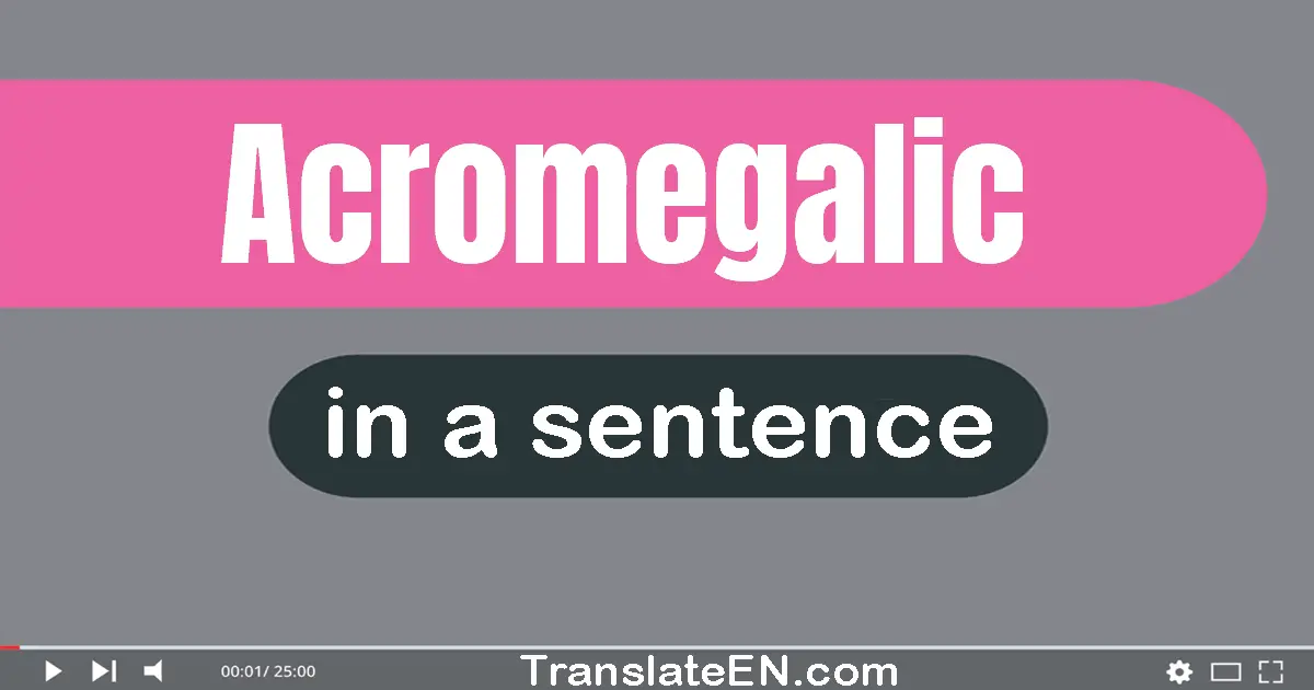 Acromegalic in a sentence