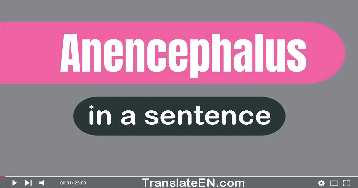 Anencephalus in a sentence