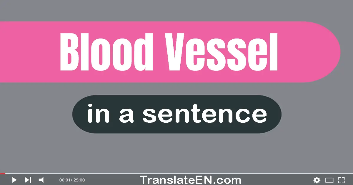 Blood Vessel in a sentence