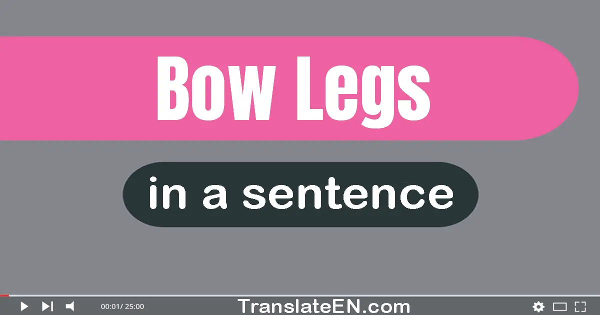 Use "bow legs" in a sentence | "bow legs" sentence examples