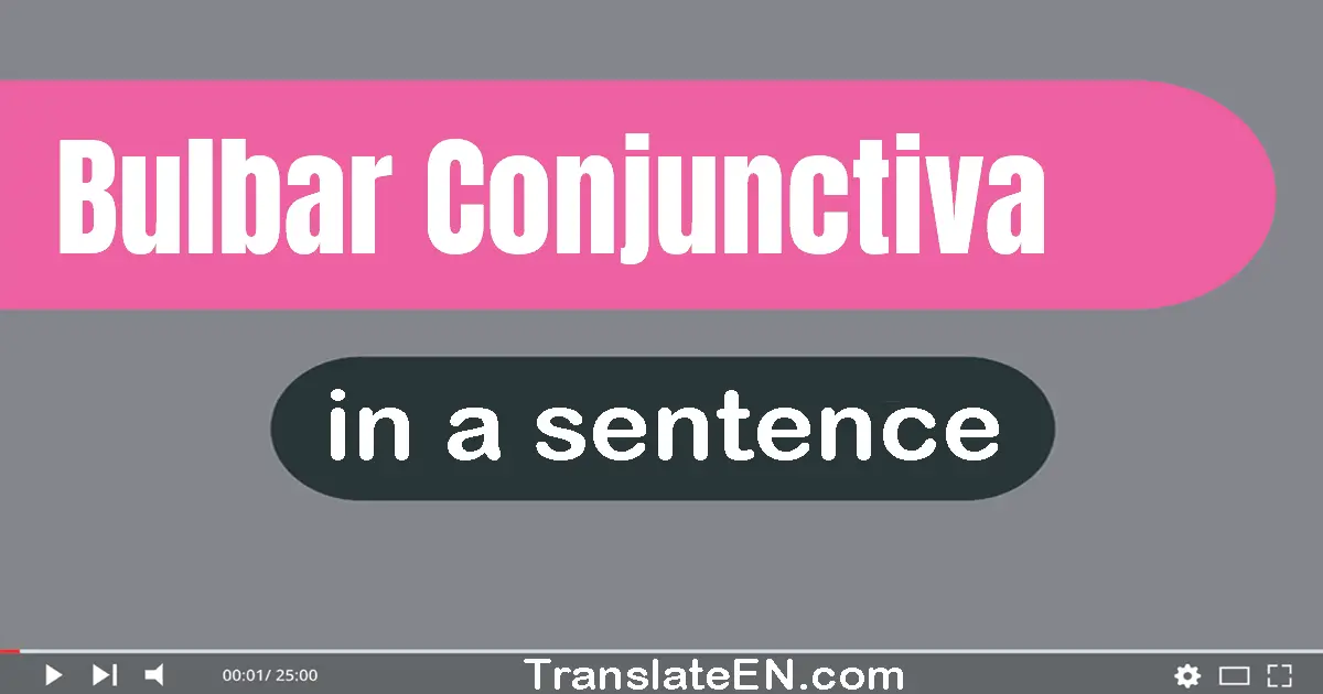 Bulbar Conjunctiva in a sentence