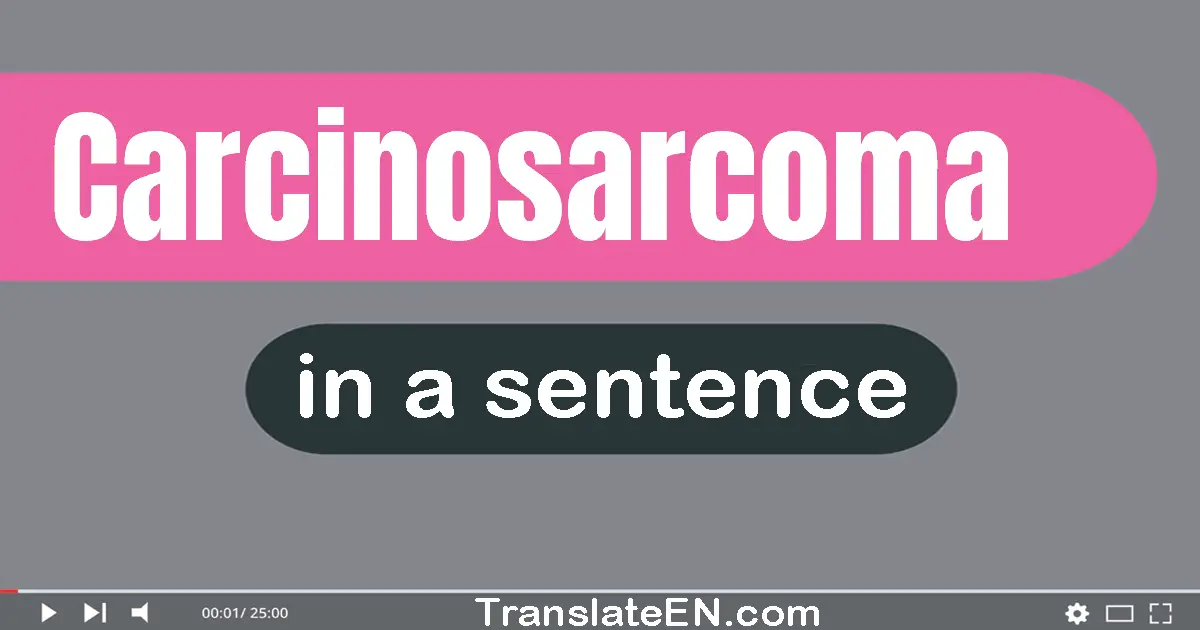 Carcinosarcoma in a sentence