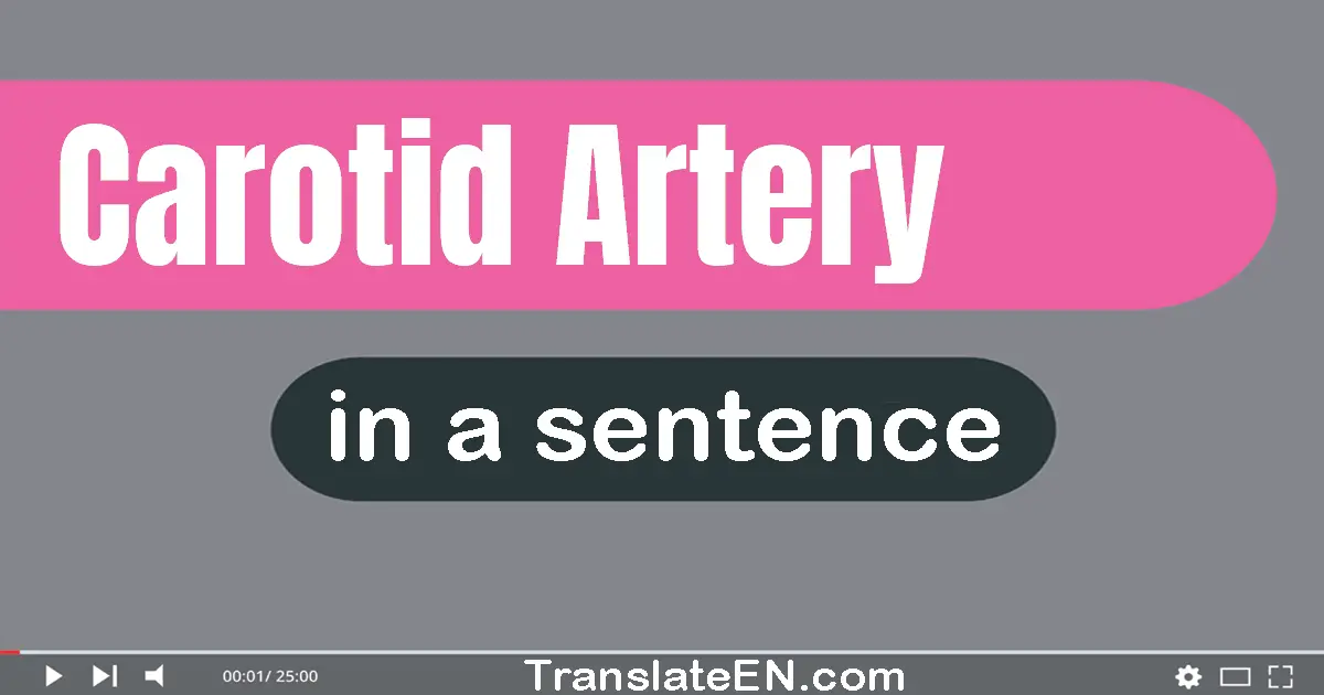 Use "carotid artery" in a sentence | "carotid artery" sentence examples