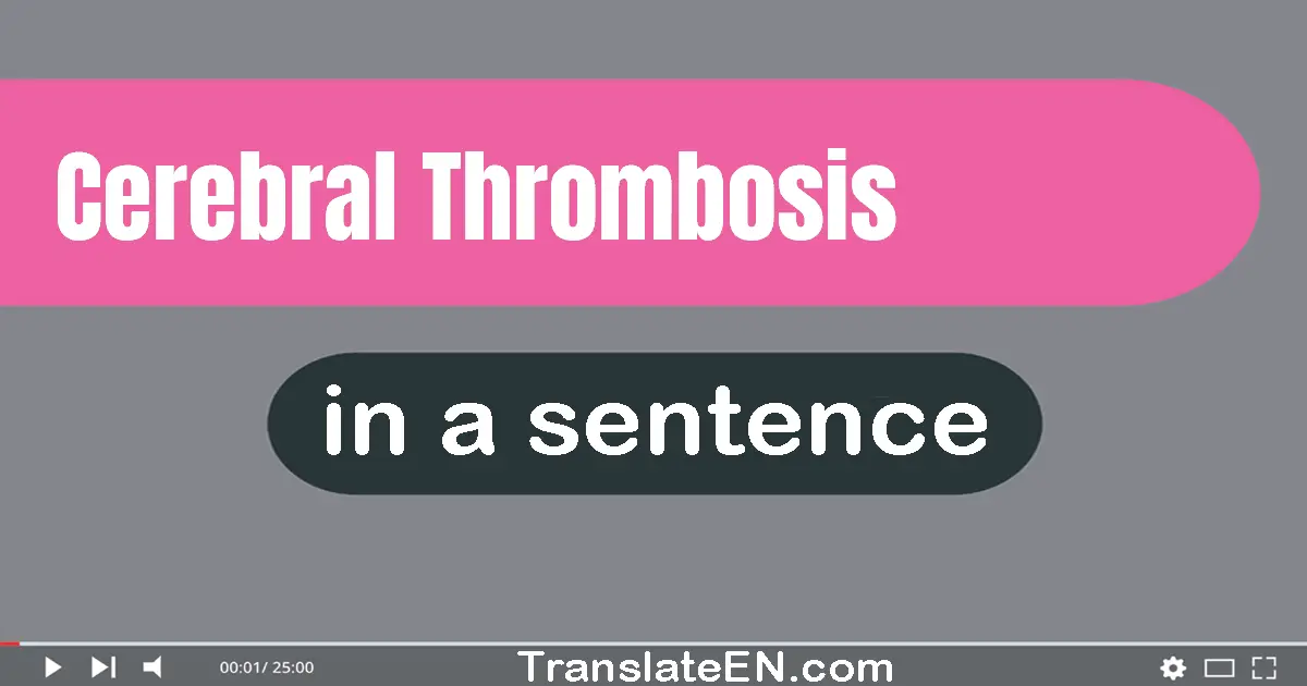 Cerebral Thrombosis in a sentence