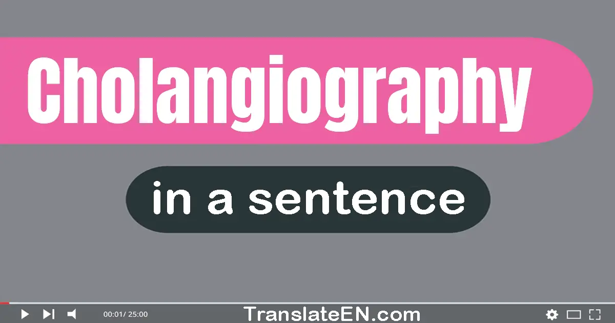 Cholangiography in a sentence