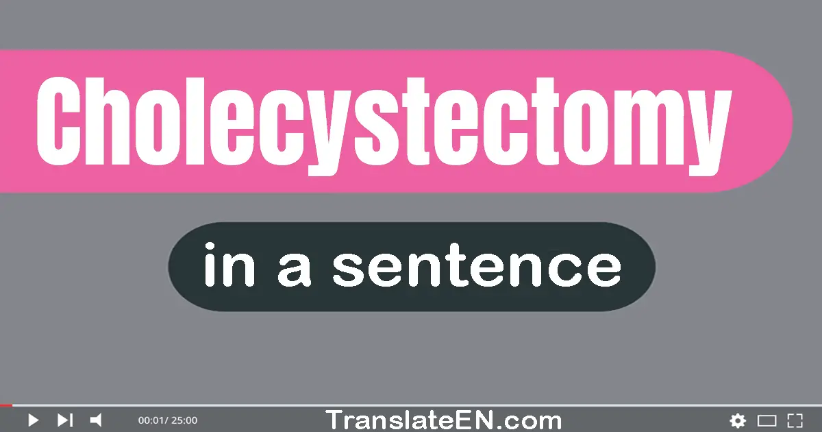 Cholecystectomy in a sentence