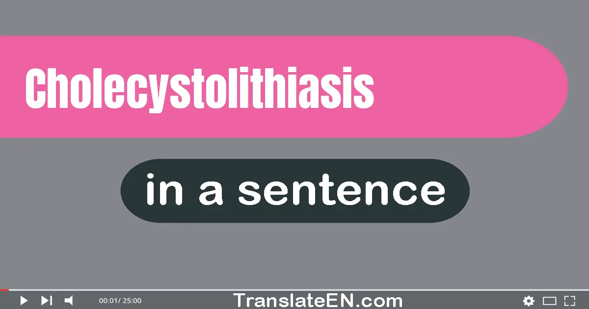 Cholecystolithiasis in a sentence