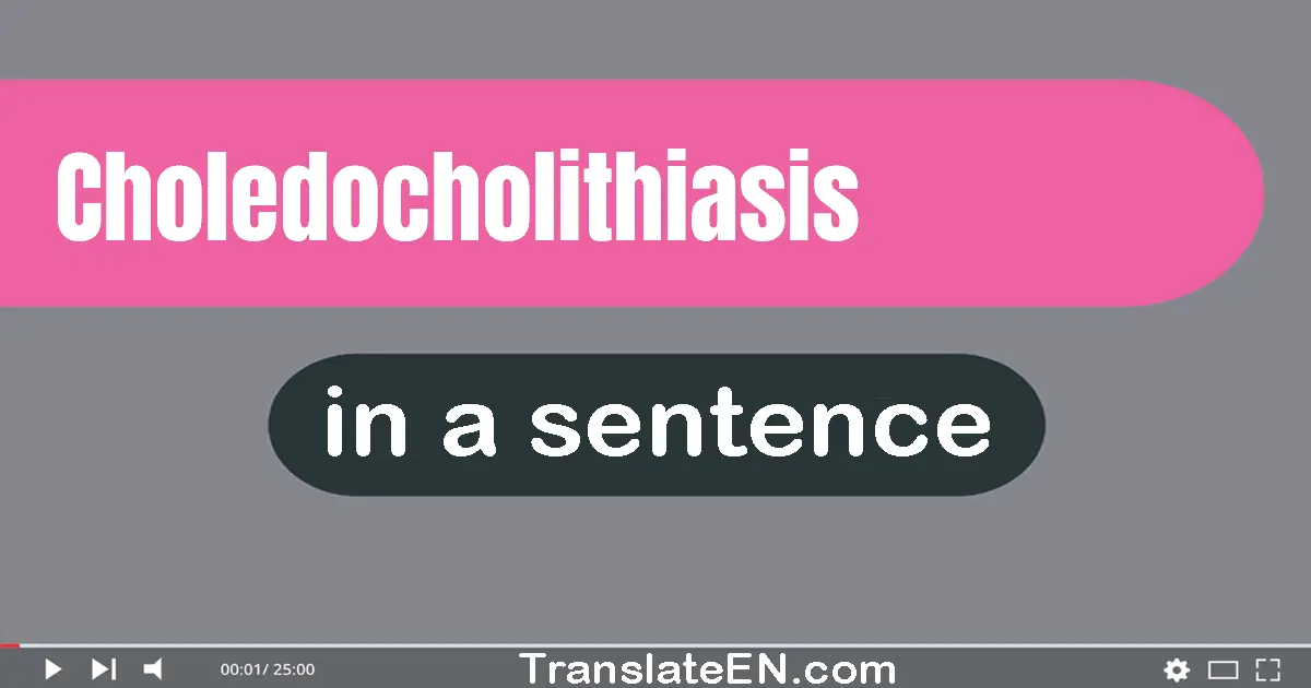 Choledocholithiasis in a sentence