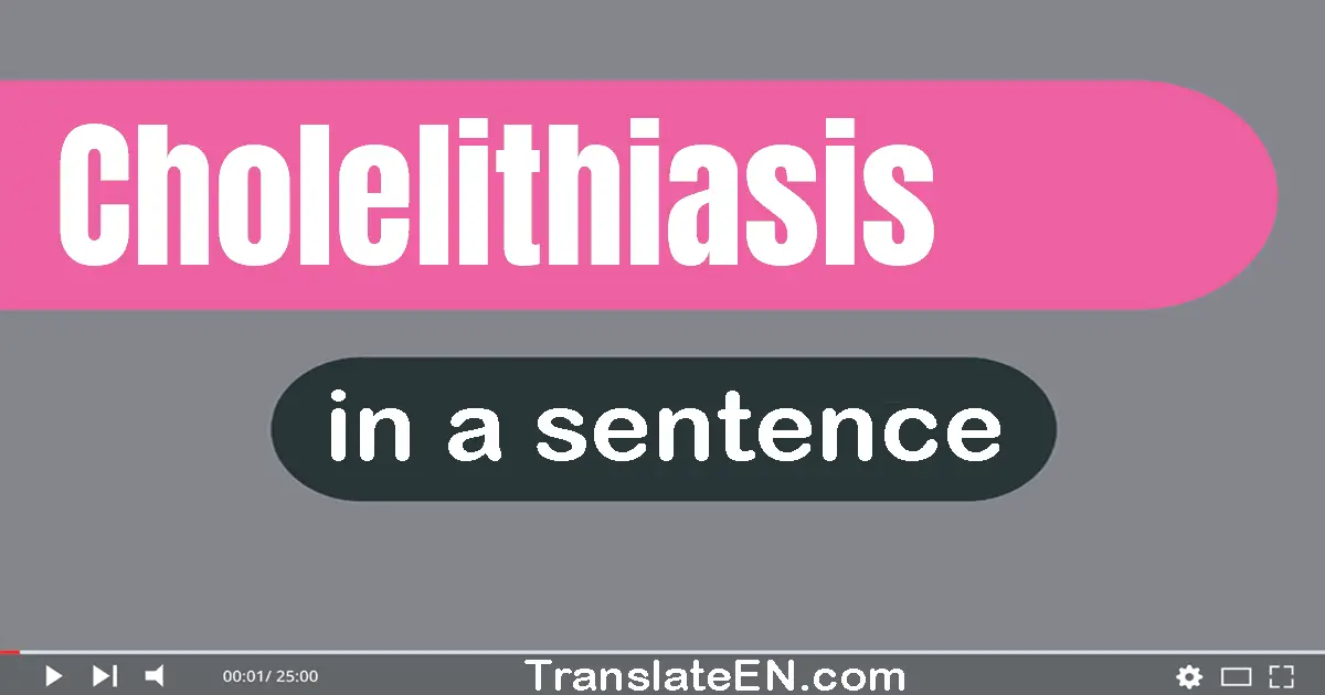 Cholelithiasis in a sentence