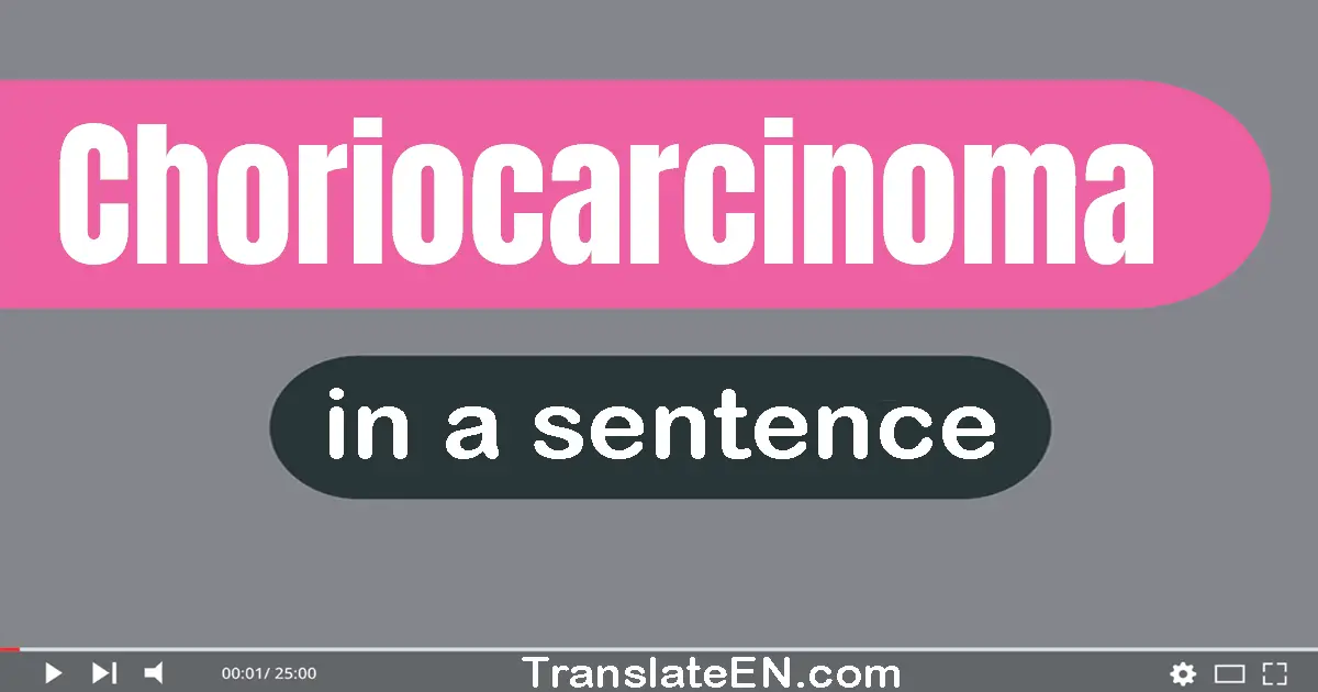 Choriocarcinoma in a sentence