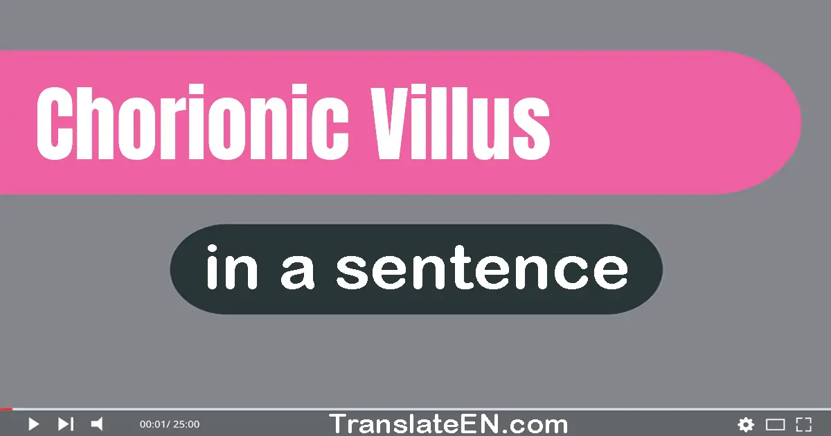 Chorionic Villus in a sentence