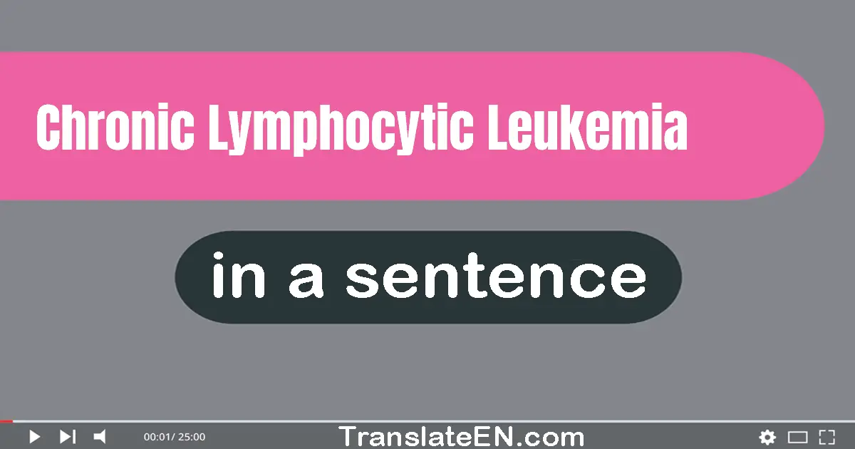 Chronic Lymphocytic Leukemia in a sentence