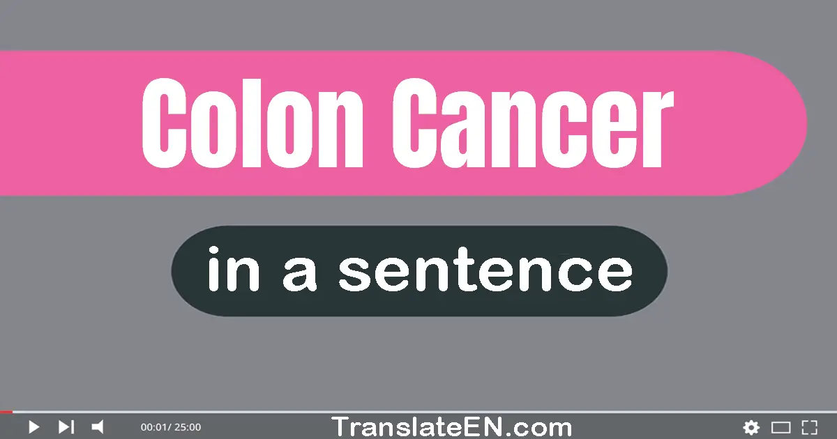 Colon Cancer in a sentence