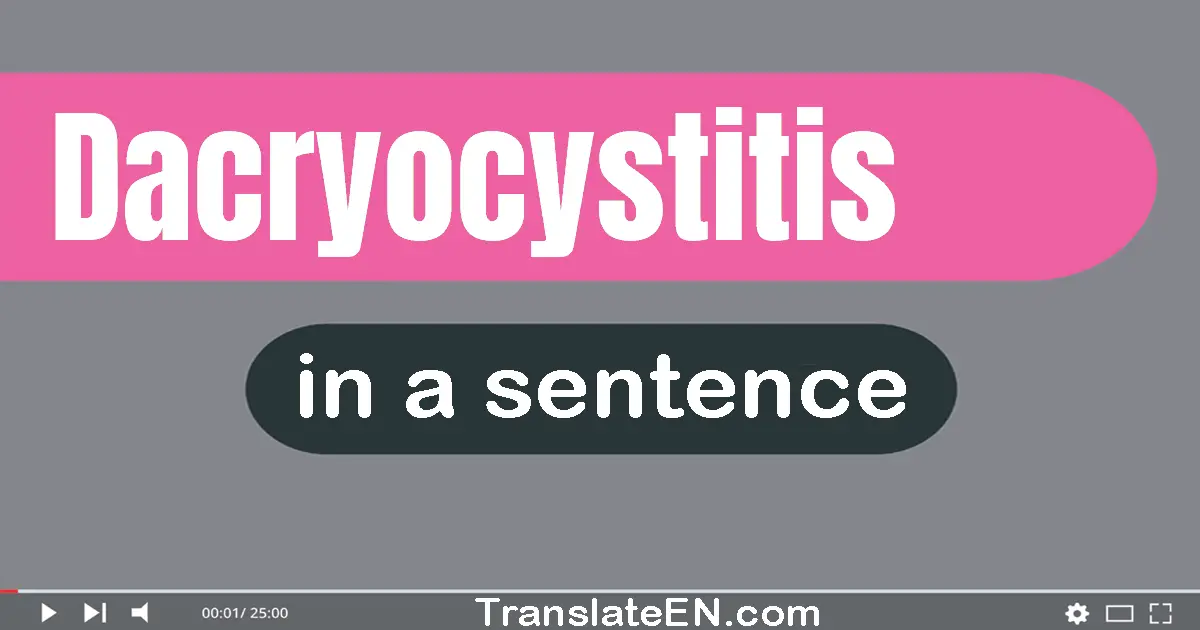 Dacryocystitis in a sentence