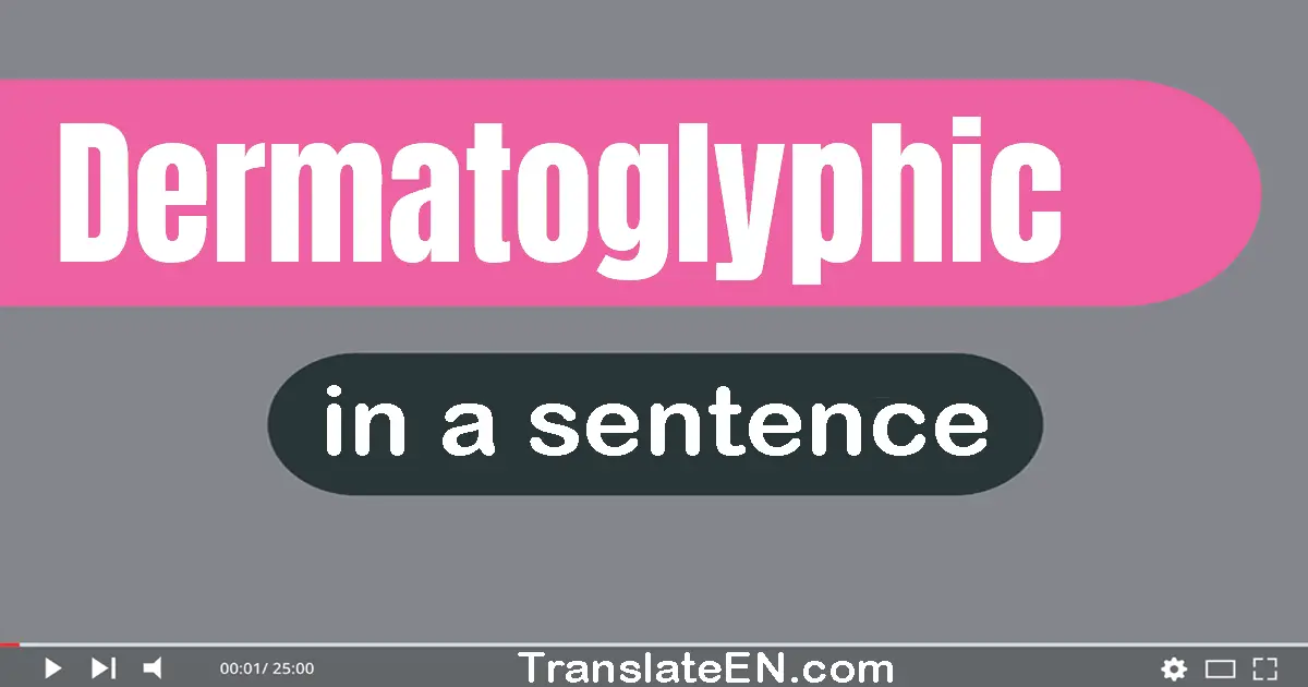 Dermatoglyphic in a sentence