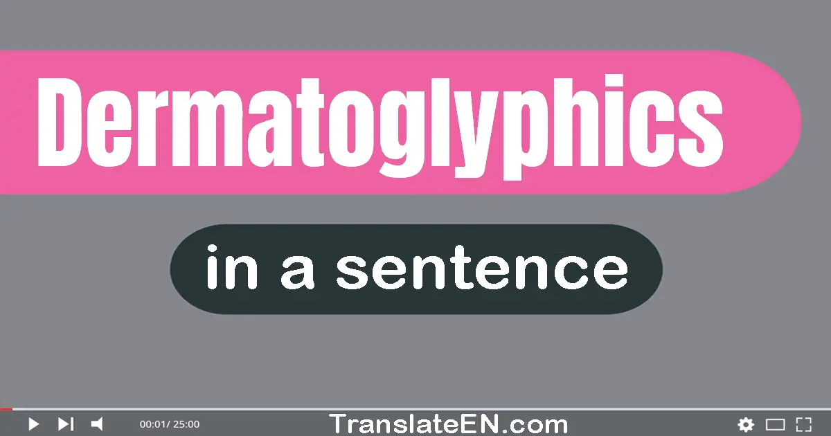 Dermatoglyphics in a sentence