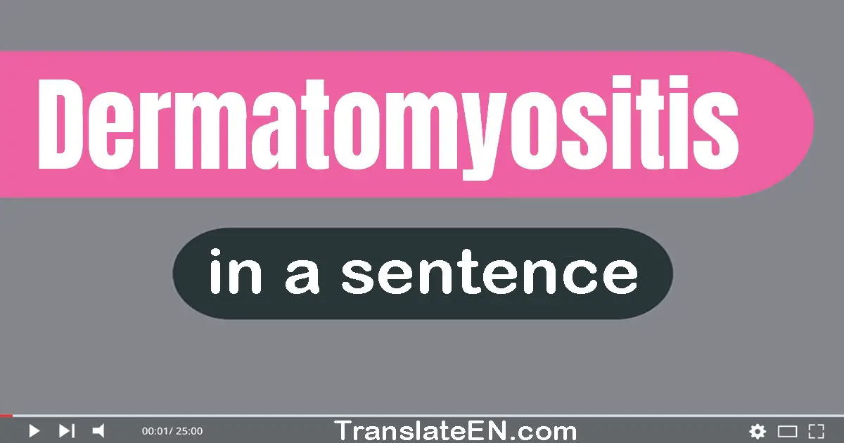 Dermatomyositis in a sentence