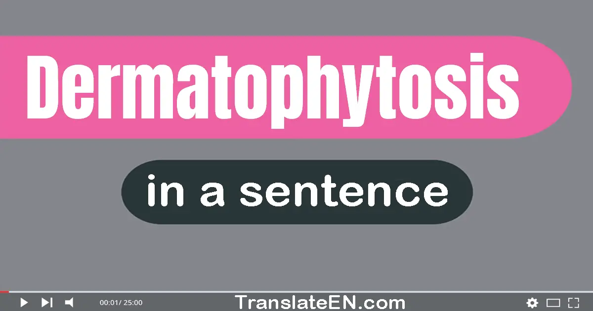 Dermatophytosis in a sentence