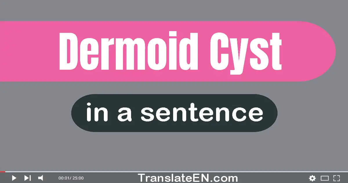 Dermoid Cyst in a sentence