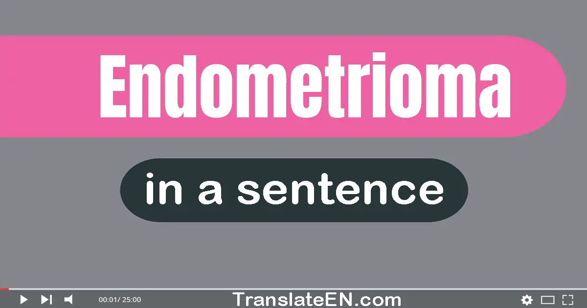 Endometrioma in a sentence