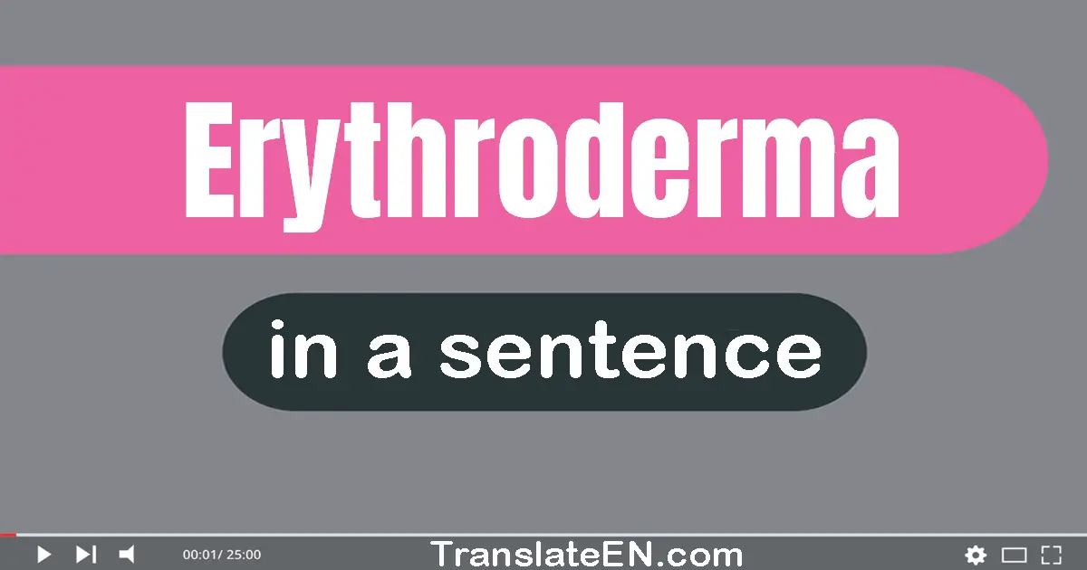 Erythroderma in a sentence