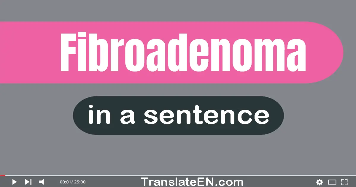 Fibroadenoma in a sentence