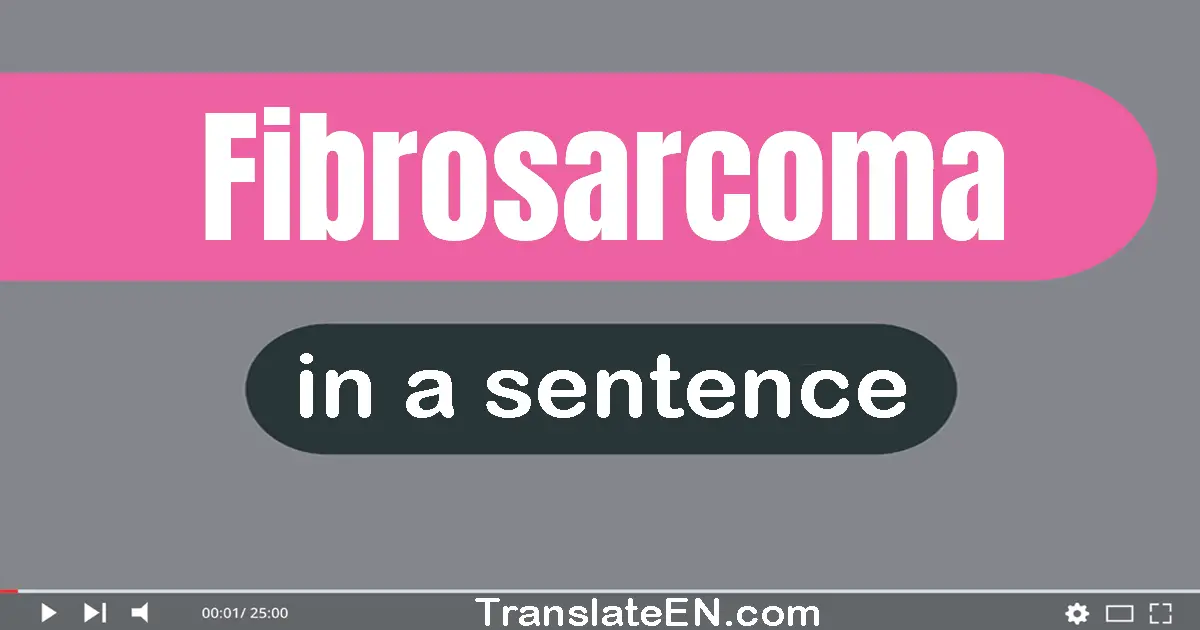 Fibrosarcoma in a sentence