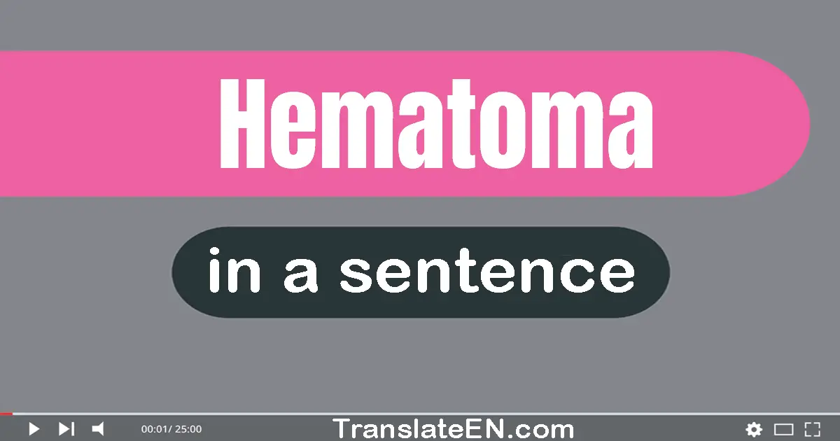 Hematoma in a sentence