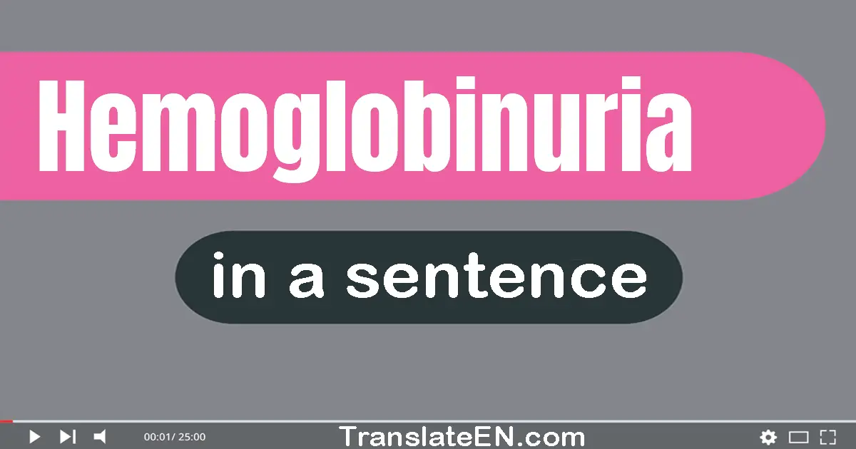 Hemoglobinuria in a sentence