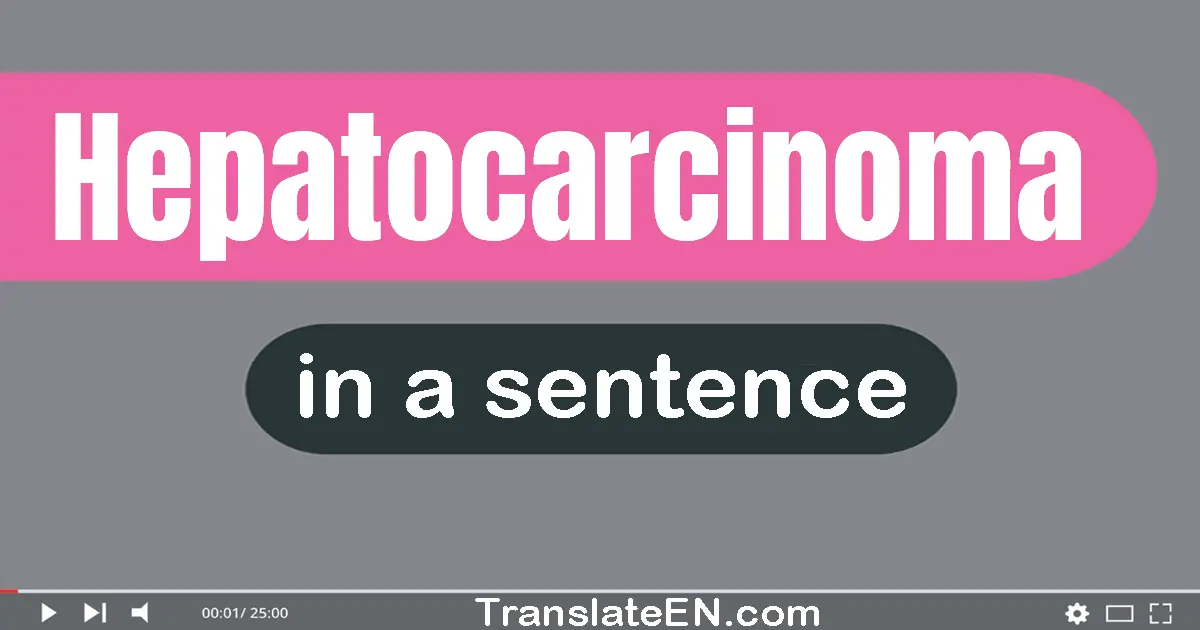 Hepatocarcinoma in a sentence