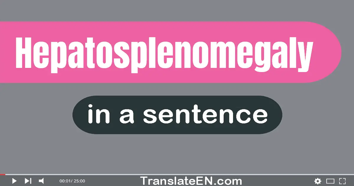 Hepatosplenomegaly in a sentence