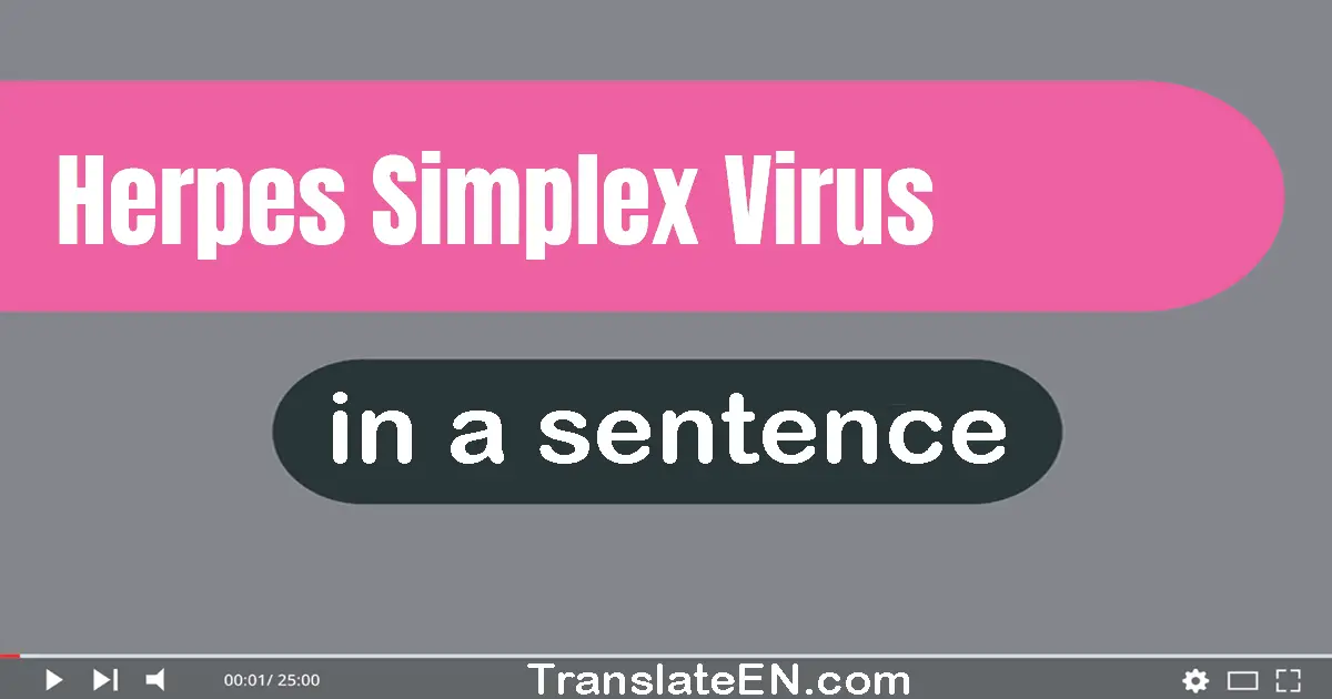 Use "herpes simplex virus" in a sentence | "herpes simplex virus" sentence examples