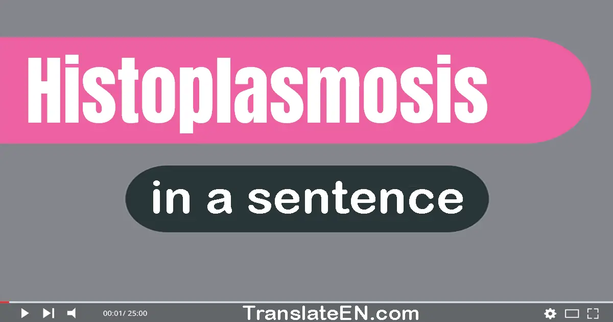 Histoplasmosis in a sentence