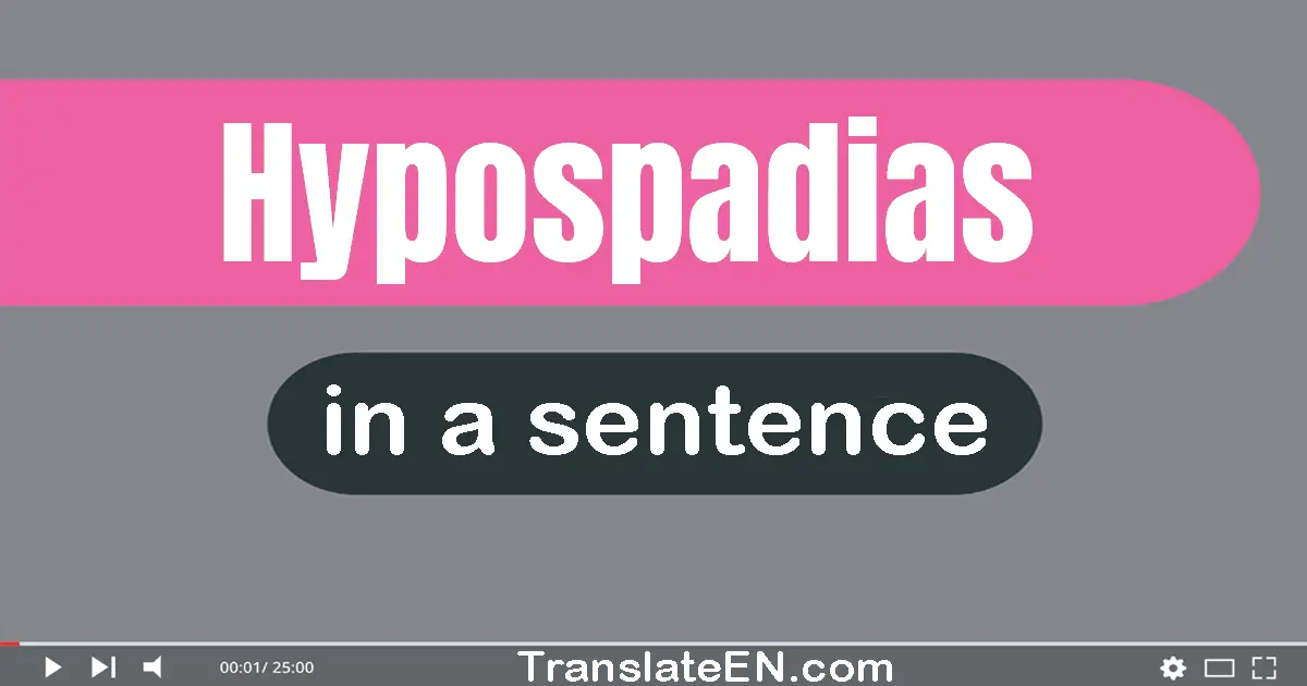 Use "hypospadias" in a sentence | "hypospadias" sentence examples