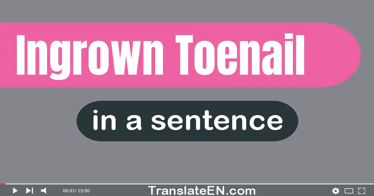 Ingrown Toenail in a sentence