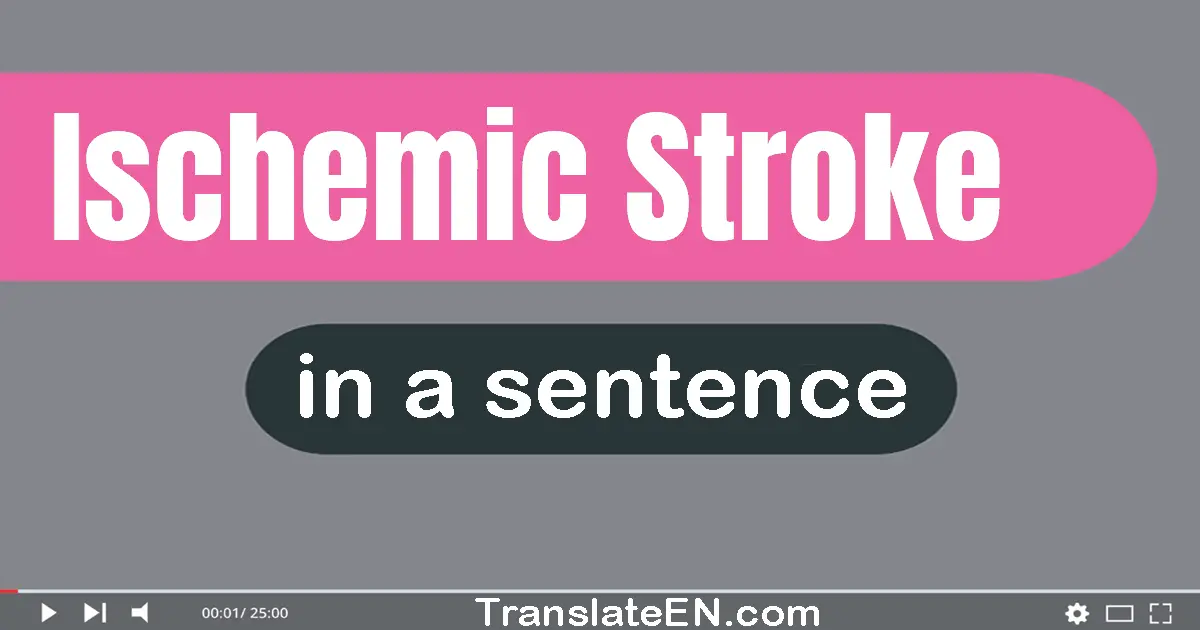 Ischemic Stroke in a sentence