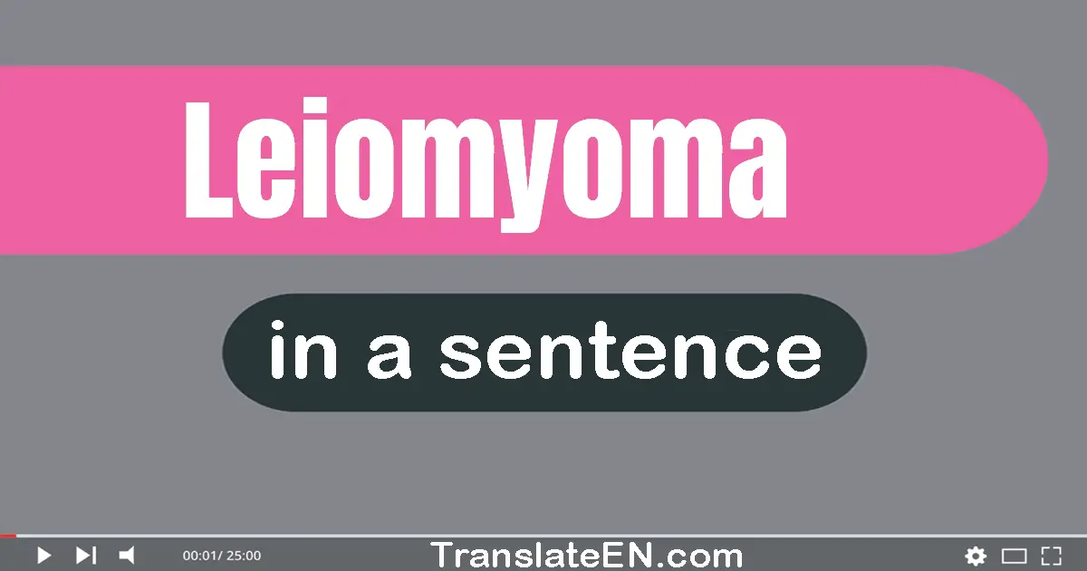 Use "leiomyoma" in a sentence | "leiomyoma" sentence examples