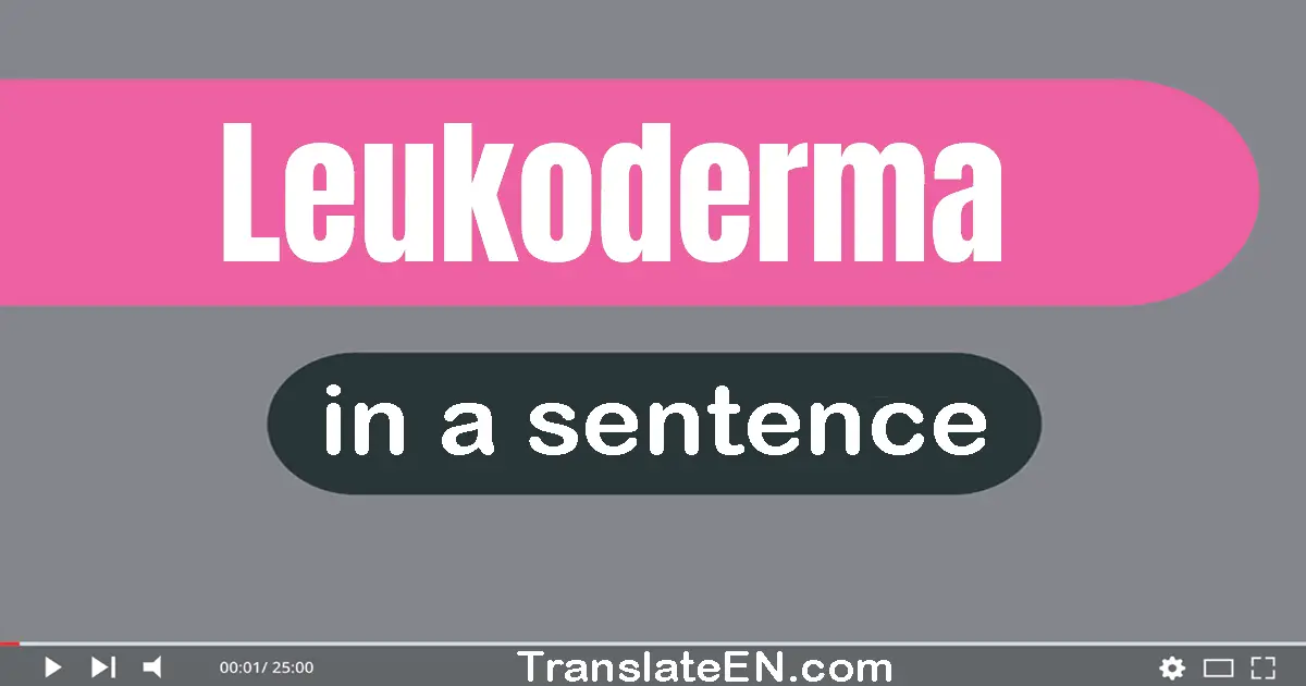 Leukoderma in a sentence