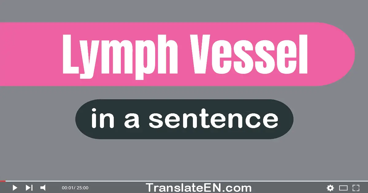 Lymph Vessel in a sentence