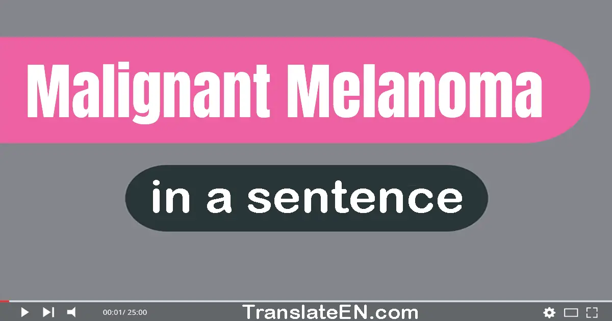 Malignant Melanoma in a sentence