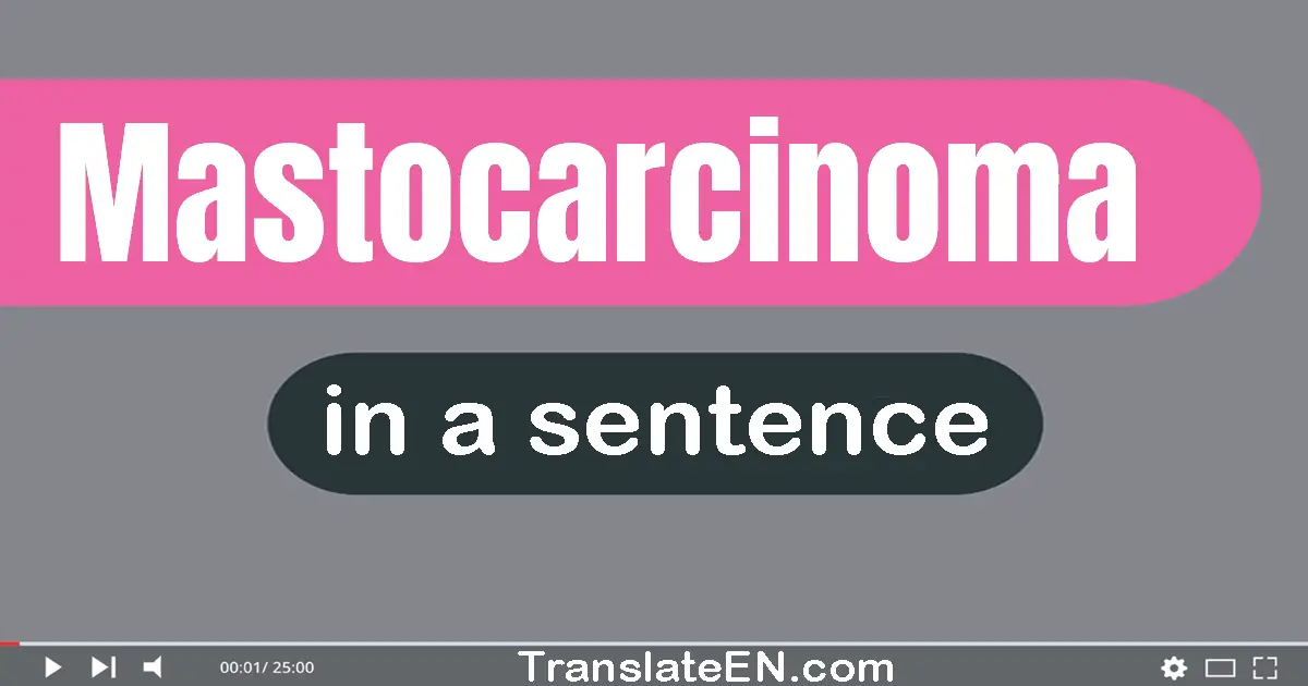 Mastocarcinoma in a sentence