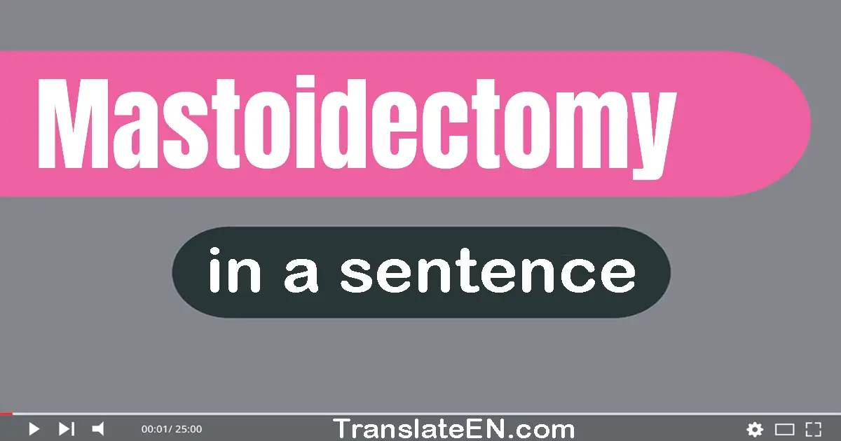 Mastoidectomy in a sentence