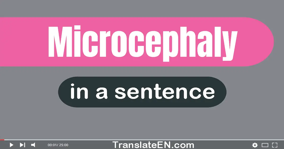 Microcephaly in a sentence