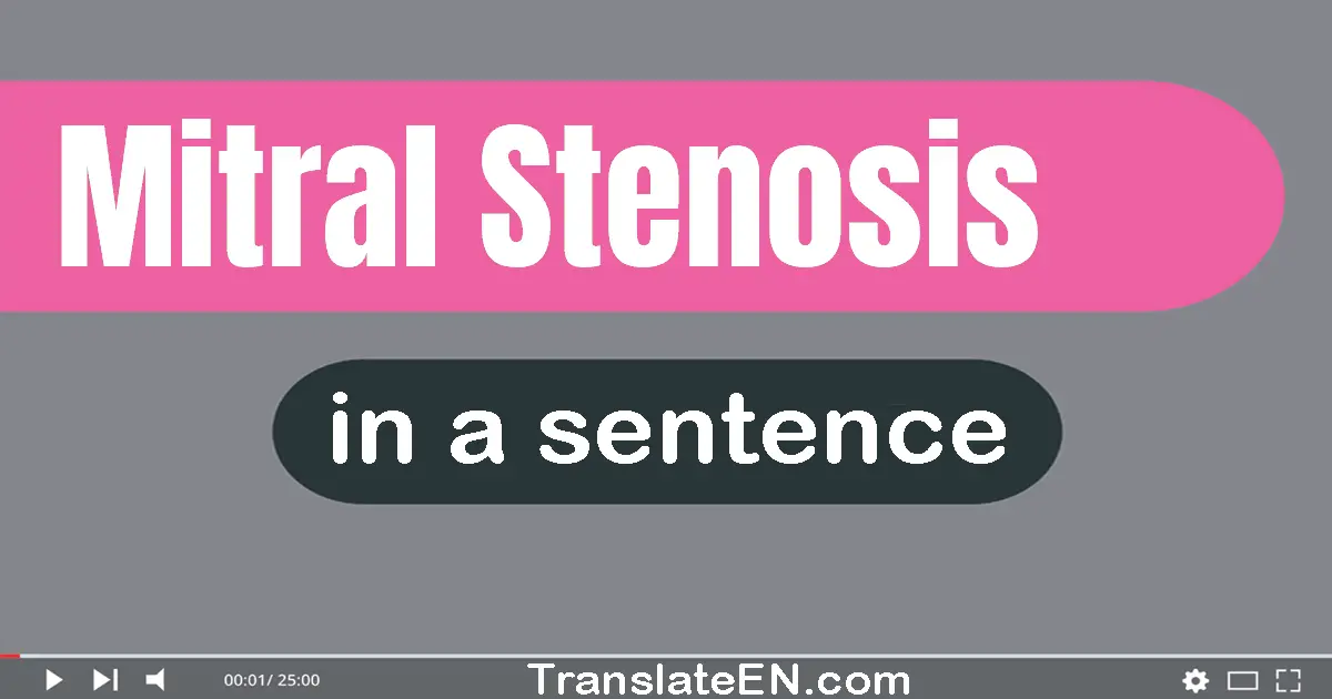 Use "mitral stenosis" in a sentence | "mitral stenosis" sentence examples