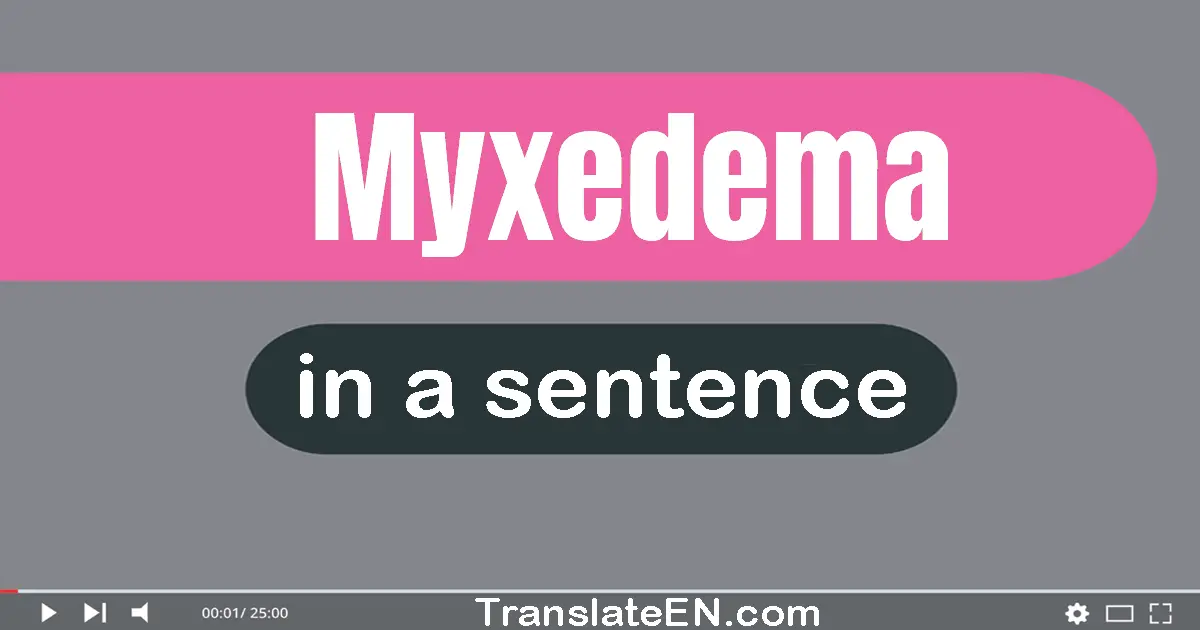 Use "myxedema" in a sentence | "myxedema" sentence examples