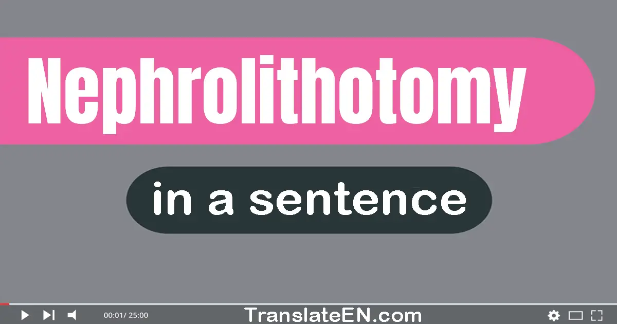 Use "nephrolithotomy" in a sentence | "nephrolithotomy" sentence examples