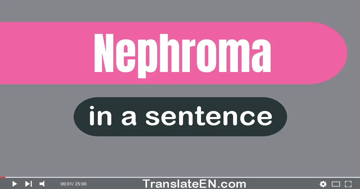 Use "nephroma" in a sentence | "nephroma" sentence examples