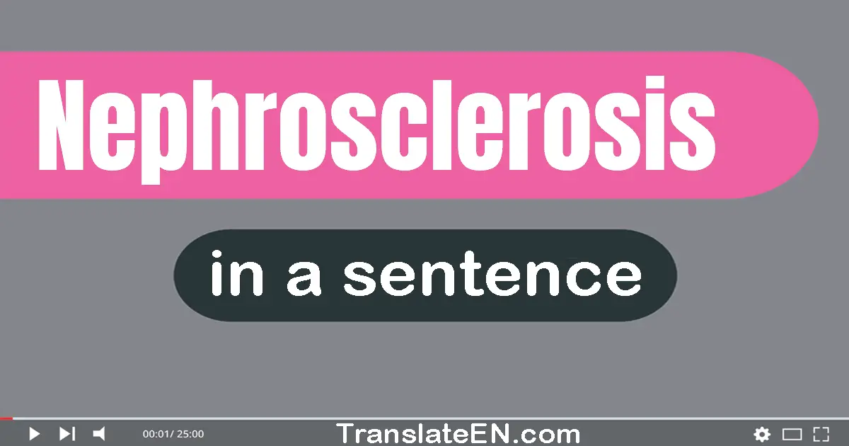 Use "nephrosclerosis" in a sentence | "nephrosclerosis" sentence examples