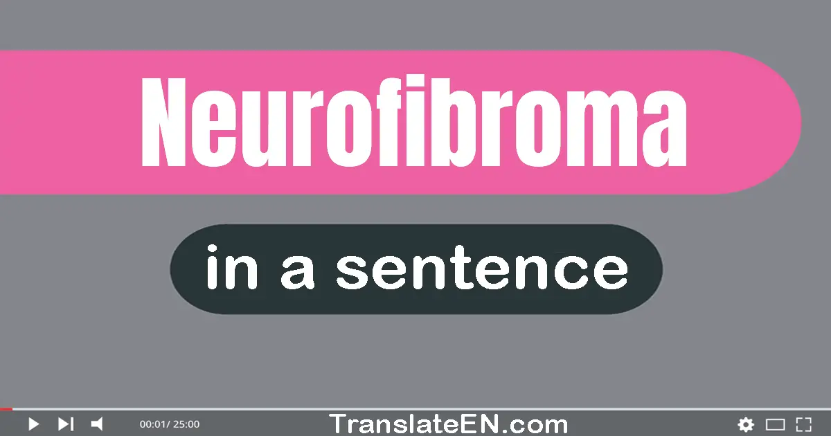 Neurofibroma in a sentence