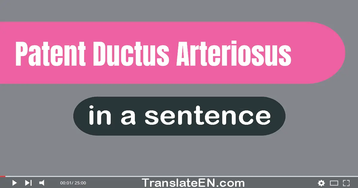 Patent Ductus Arteriosus in a sentence